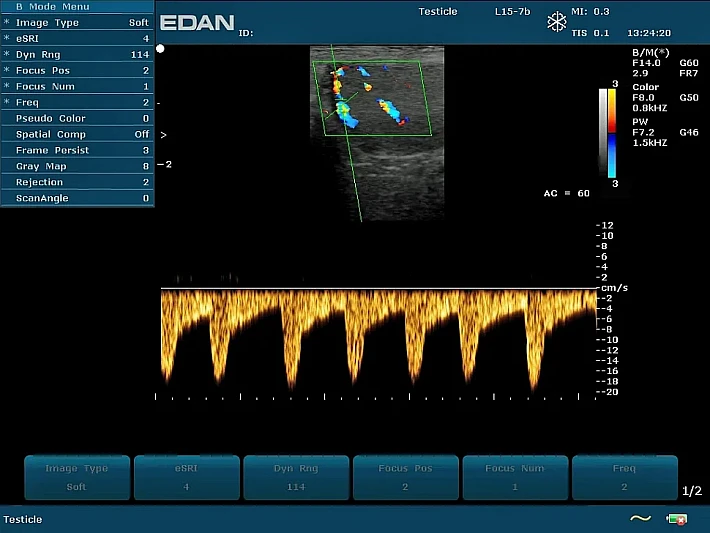 U50 PE L15-7b Colour testis (2)_result