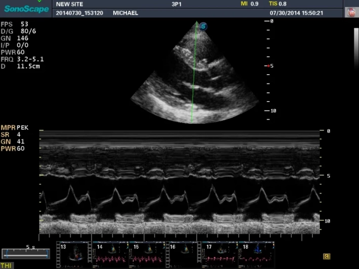 8. М-режим_result
