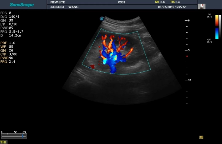 5. Почка_ЦДК_result