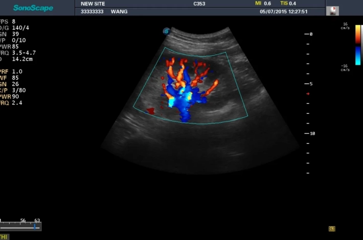 5. Почка_ЦДК_result