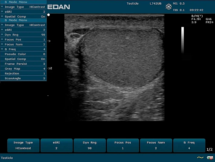 U50 PE L742UB Testicle_result