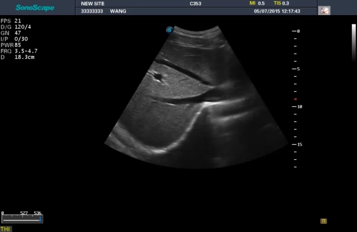 1. Печень_result