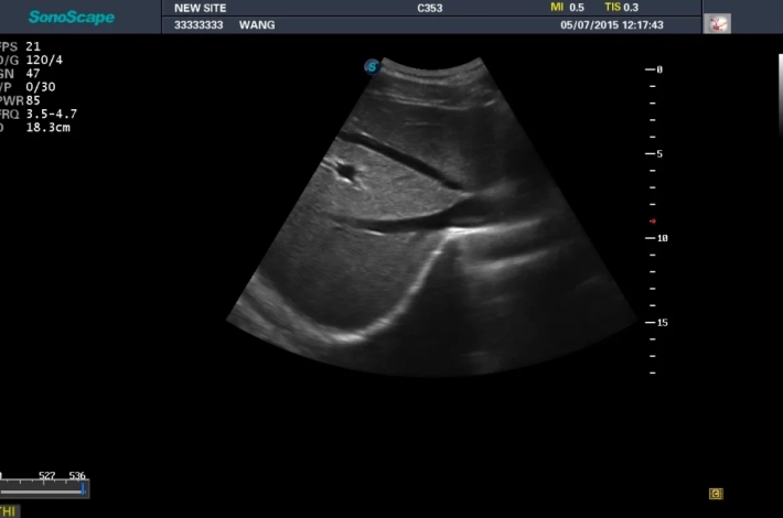1. Печень_result