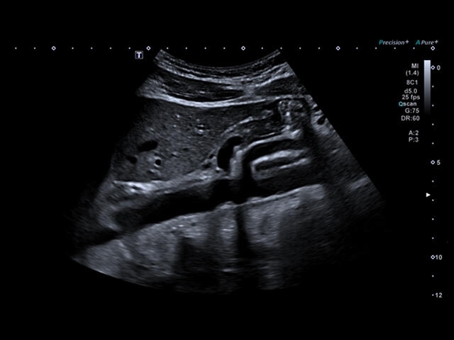 8nzn307y6jhdw7coxu1m4jpj2u7zouds