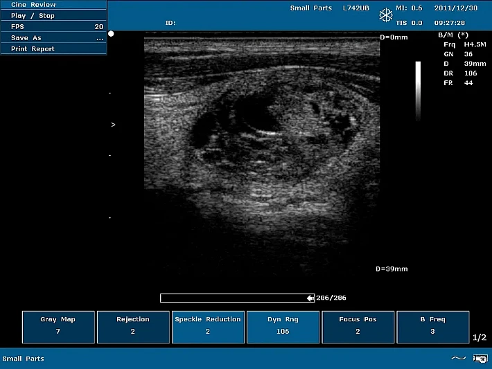 U50 PE L742UB Hamonic Imaging Shows Near Field detail_result