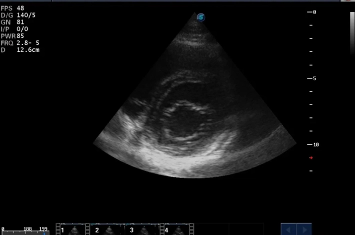 2. ЛЖ короткая ось_result