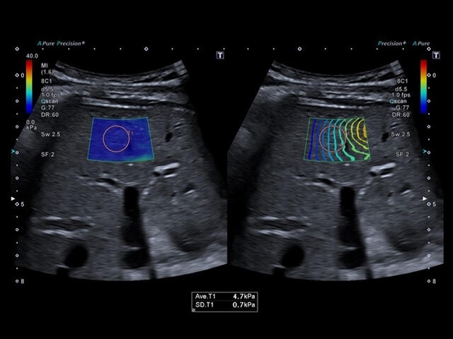 39h6v9g920m86sxrlzwyubn07i5ece00