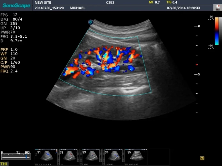 4. Почка_ЦДК_result