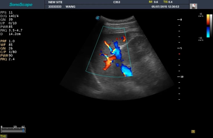 4. Селезенка_ЦДК_result