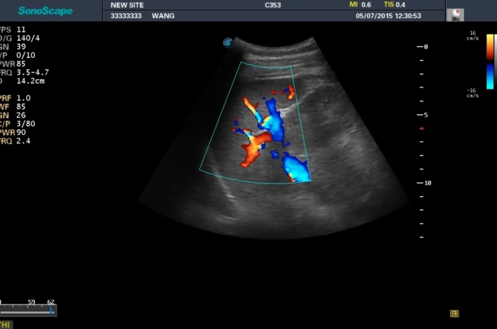 4. Селезенка_ЦДК_result