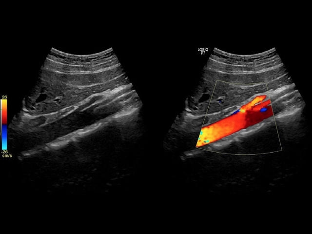 aorta-4c.e11559ceafc2c1e437dabf0bb585bdb9519