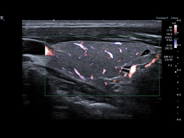 53xrjmndxwnlfa8l7fu6az1w6s0s4aiv