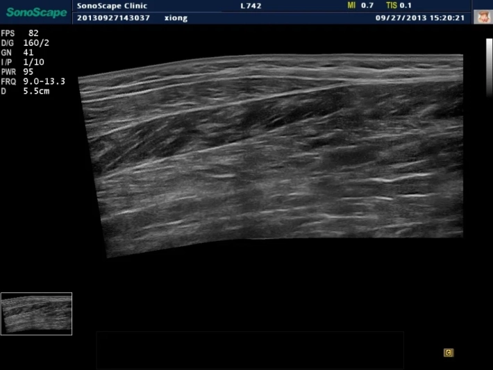 16. Режим панорамного сканирования_result