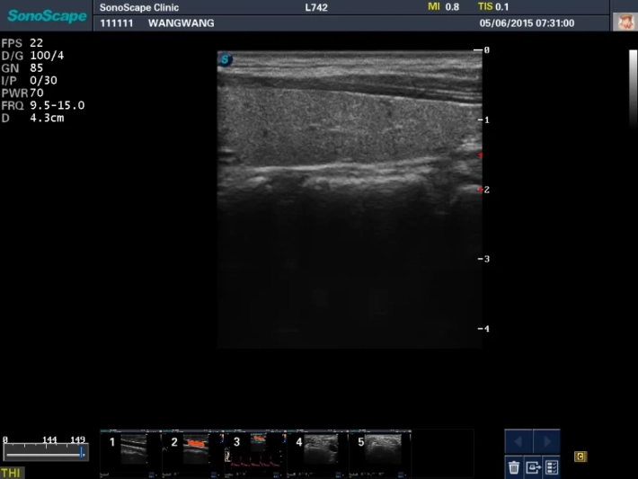 6. Щитовидная железа_result