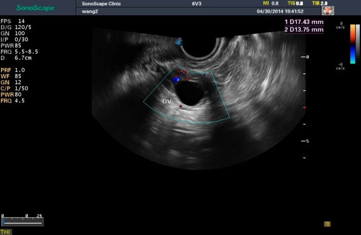8. Яичник_ЦДК_result