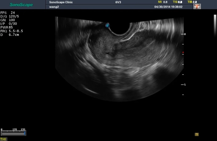 6. Матка_result