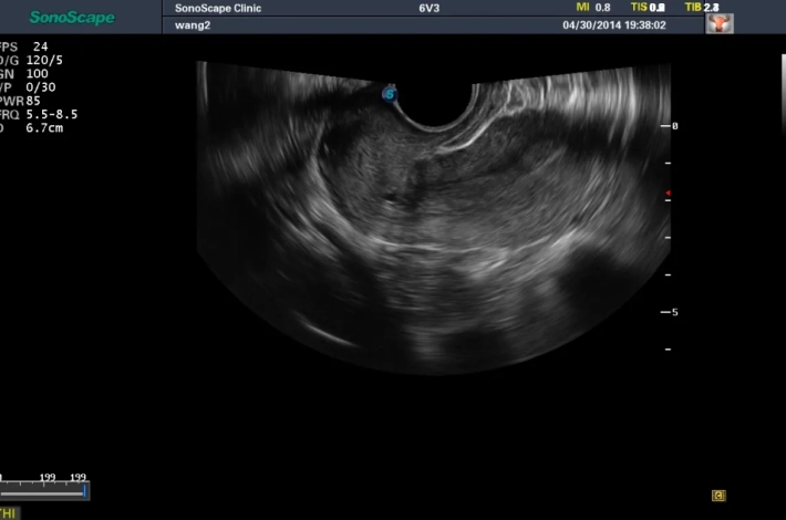 6. Матка_result