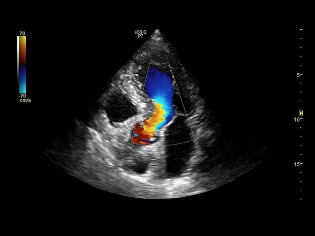 heart-3sc.e11559ceafc2c1e437dabf0bb585bdb9519