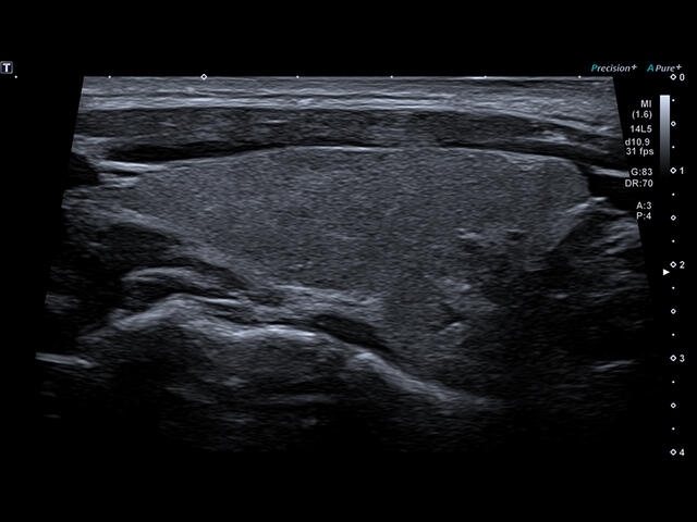 anzr3x95w3by93ea7iitiz1l6u17f6t7