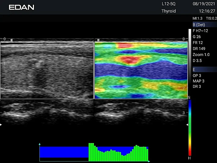 AX3 L12-5Q Elastic_result
