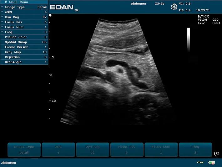 U50PE C5-2b Pancreas_result
