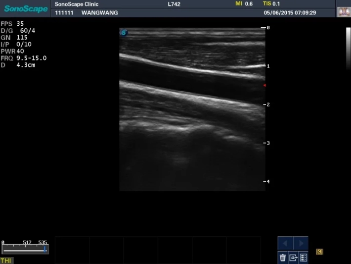 12. Общая сонная артерия_result