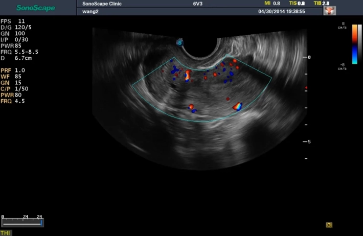 7. Матка_ЦДК_result