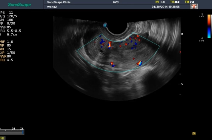 7. Матка_ЦДК_result