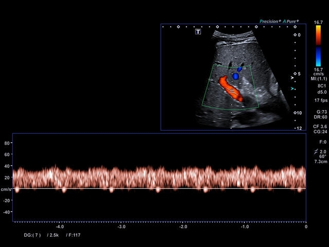 d539v0u9xqtsmtmjm2ipipvfcvspihiz