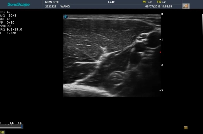 8. Мышечно-кожный нерв_result