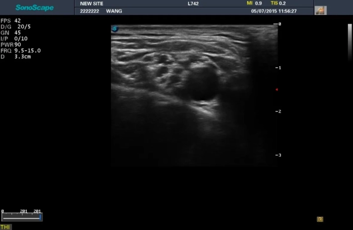 8. Надключичная часть плечевого сплетения_result
