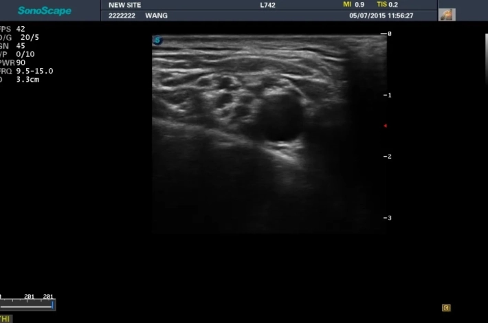 8. Надключичная часть плечевого сплетения_result