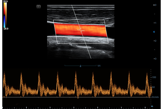 mindraysss4_2022-11-24-135720_zssm