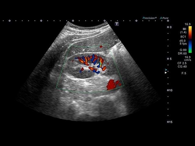 fg2twieb9lrqb2ppph8flk69lx609xkp