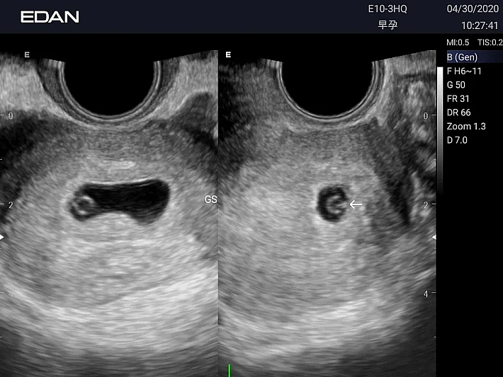 E10-3HQ Early OB_result