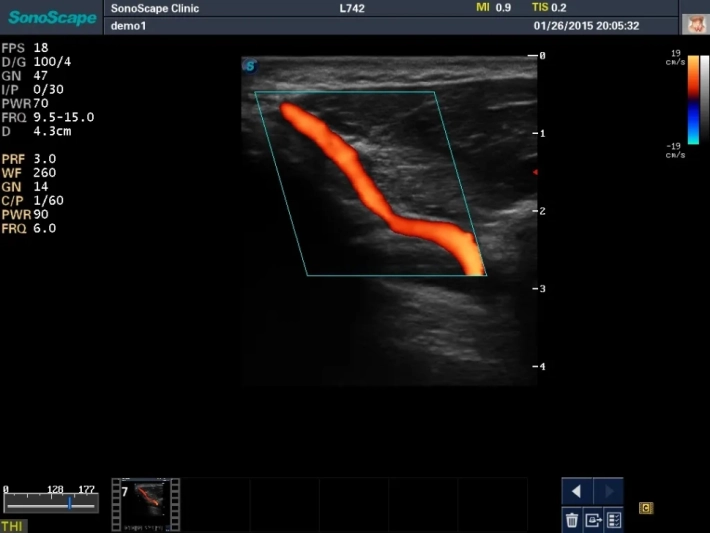 15. Ладонная дуга_ЦДК_result