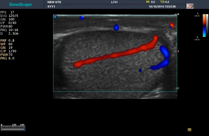 10. Яичко_result