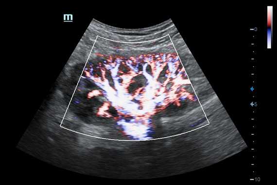 mindraysss6_2022-11-24-135730_nloc