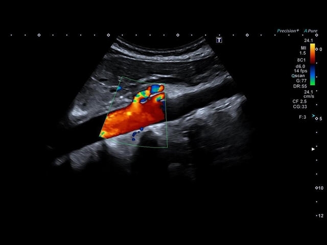 gx7cpgody0t8w5iiaqv7d4ssn4jgwibj