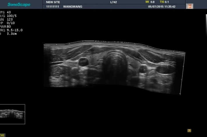 13. Панорамное изображение_result