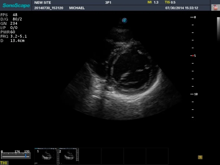 5. ЛЖ короткая ось_result
