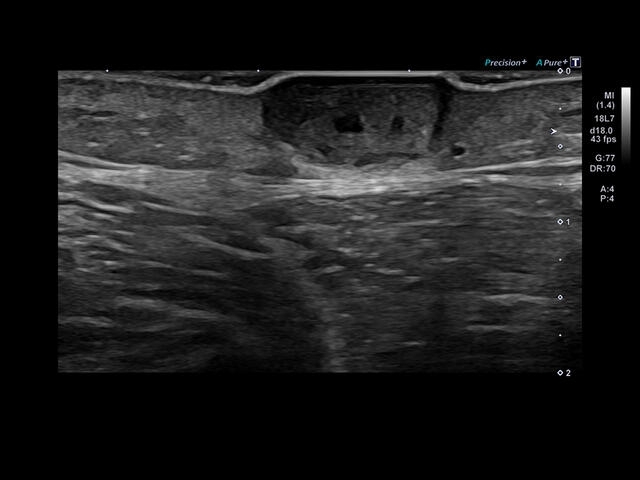 kbfp312109dqxpf95fxi4pxaxy7bhz8v