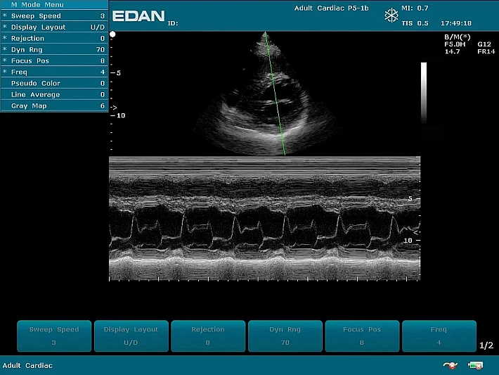 U50PE P5-1b Cardiac (10)_result