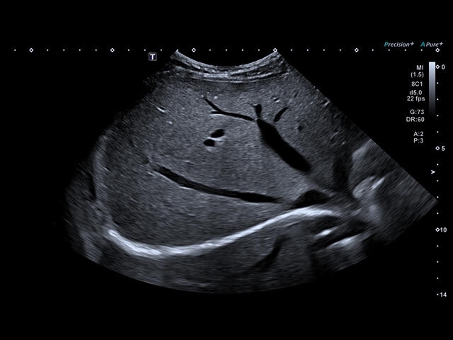 kxwn2hu8iefttafhlzprsv4crfc2hkbh