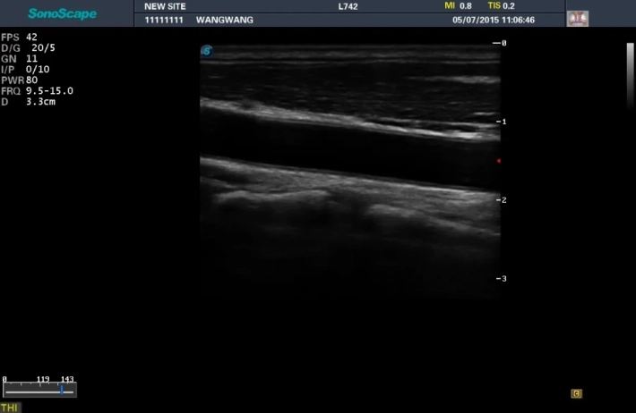 10. Сонная артерия_1_result