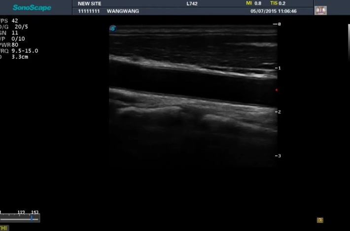10. Сонная артерия_1_result
