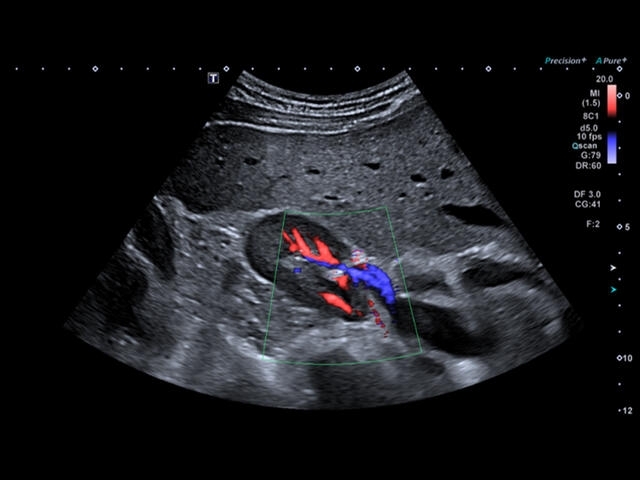 w5j9htbxetxu81d60iv36kx93662br1y