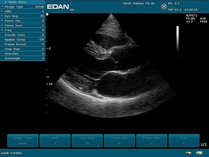 U50PE P5-1b Cardiac (3)_result