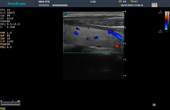8. Щитовидная железа_ЦДК_result