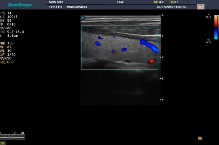 8. Щитовидная железа_ЦДК_result